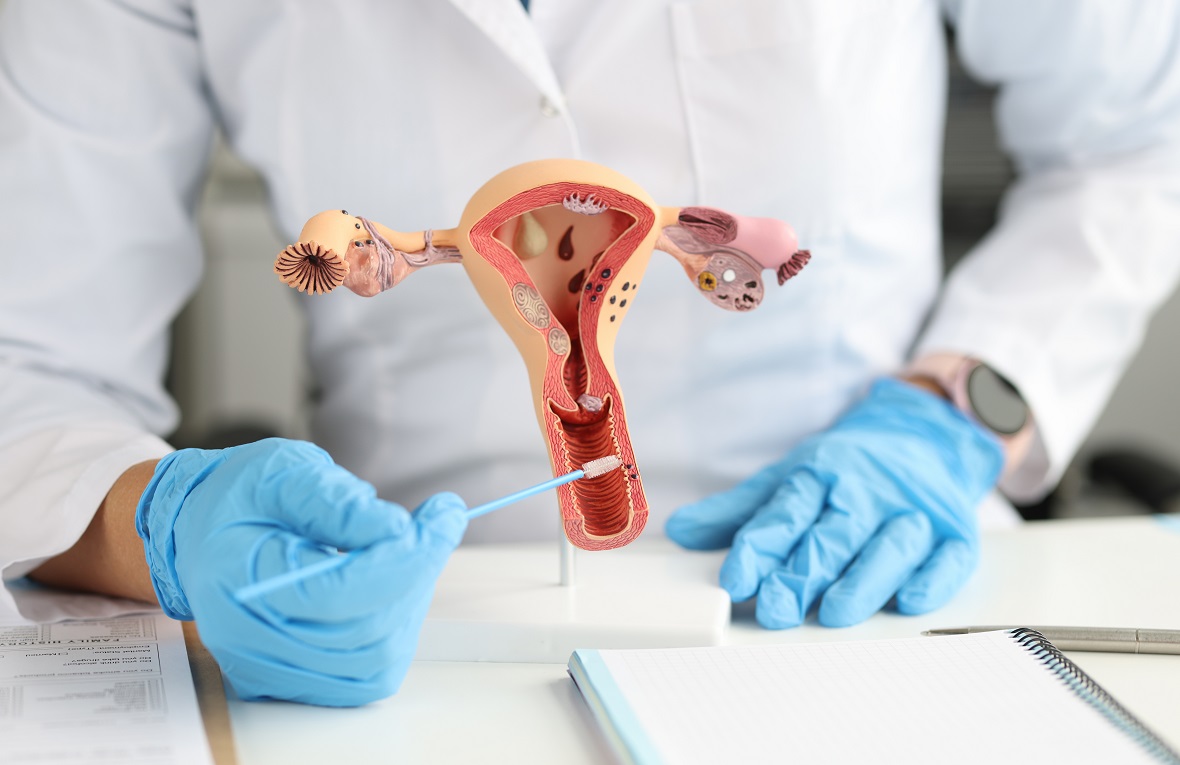 IUI Treatment
