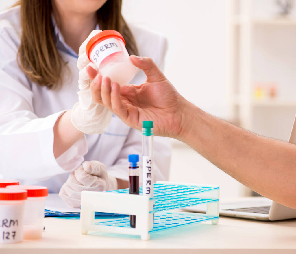 Semen analysis test