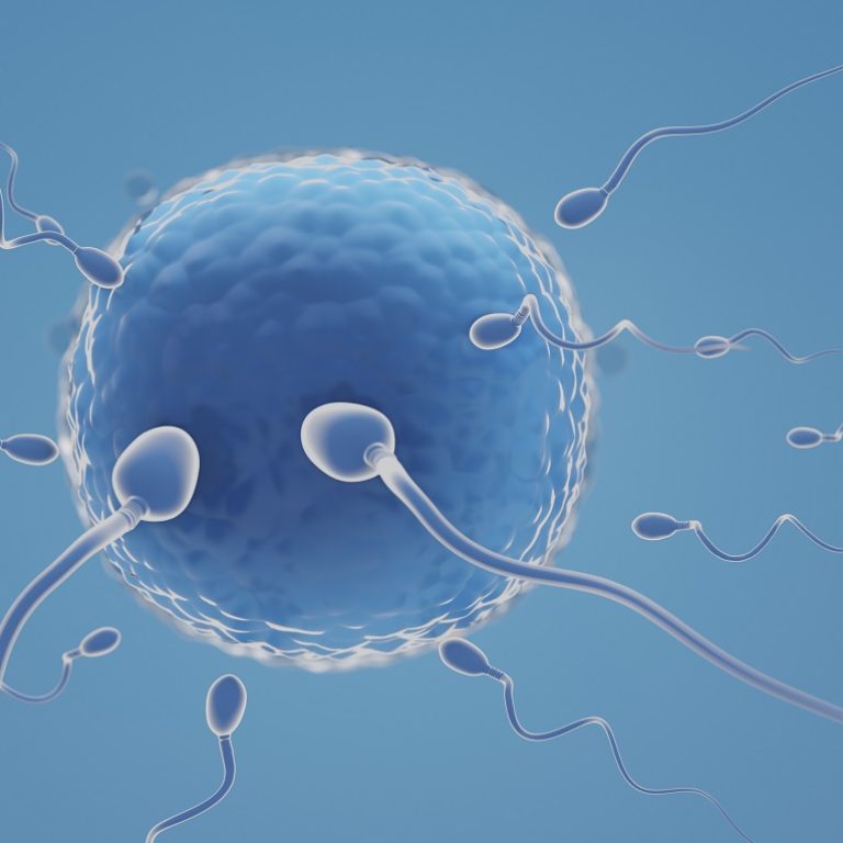 IVF Treatment
